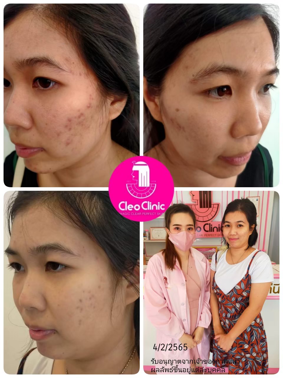 รีวิว ปี 62