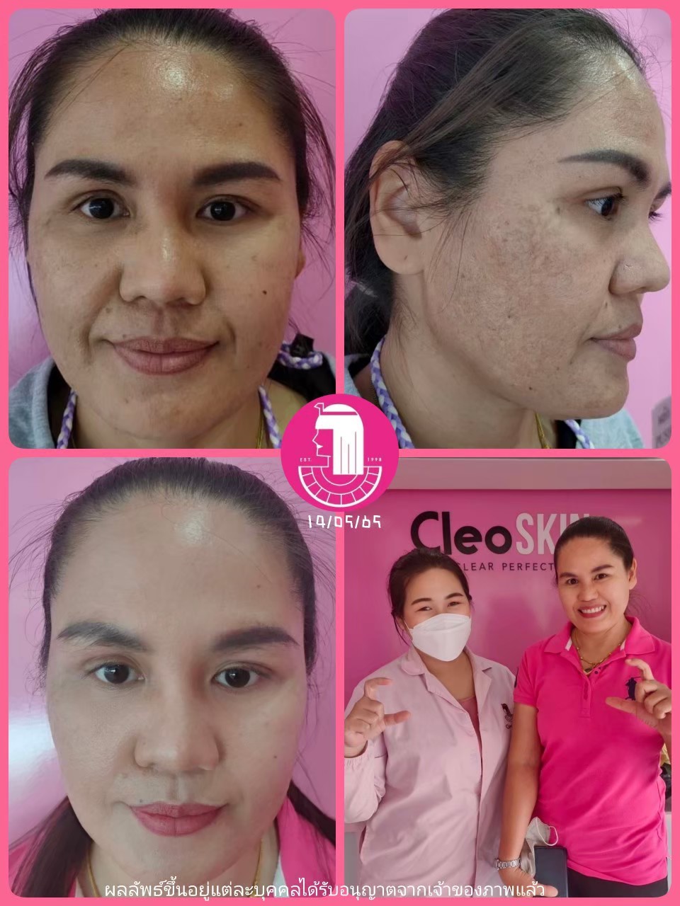 รีวิว ปี 62