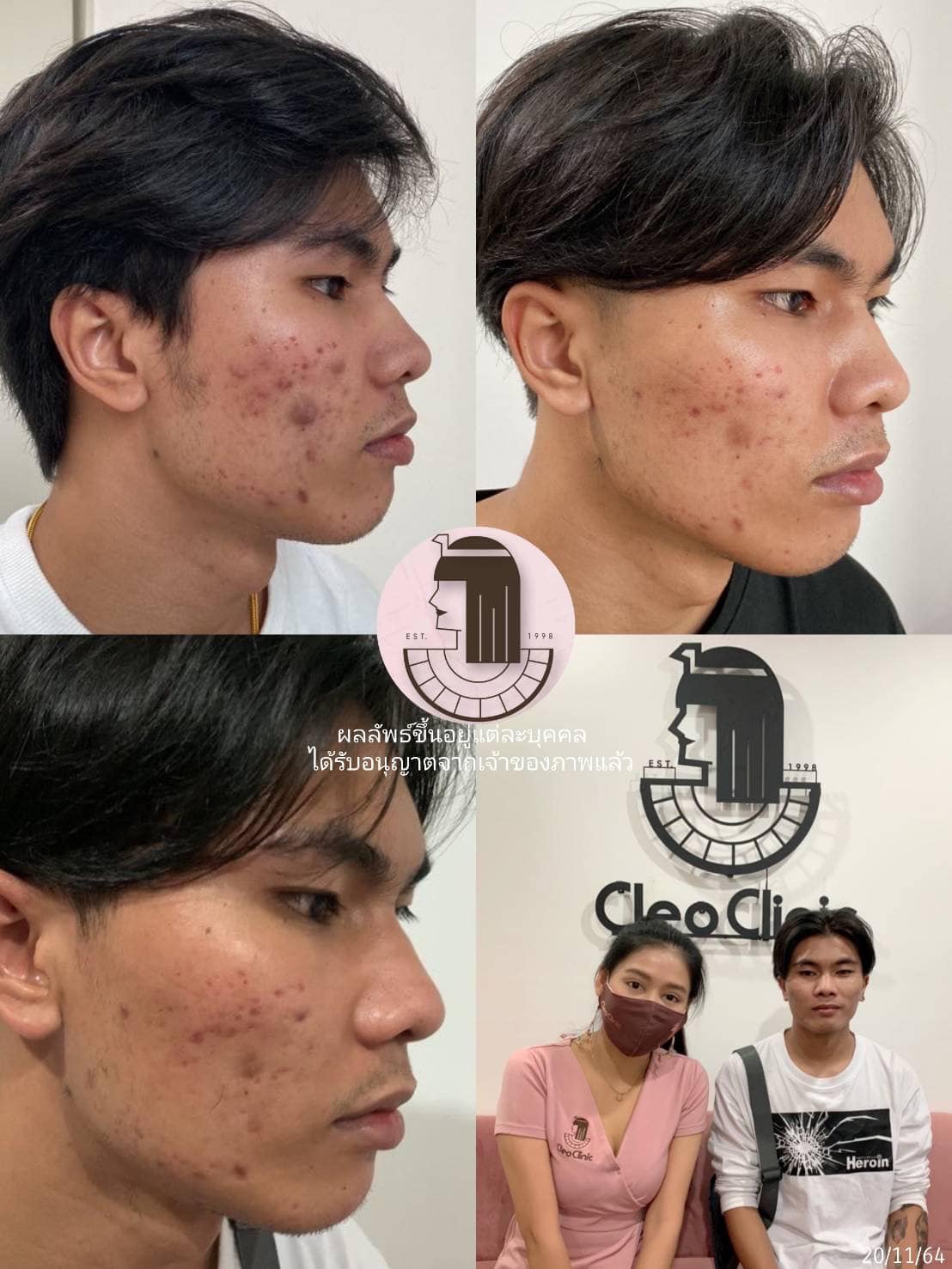 รีวิว ปี 62