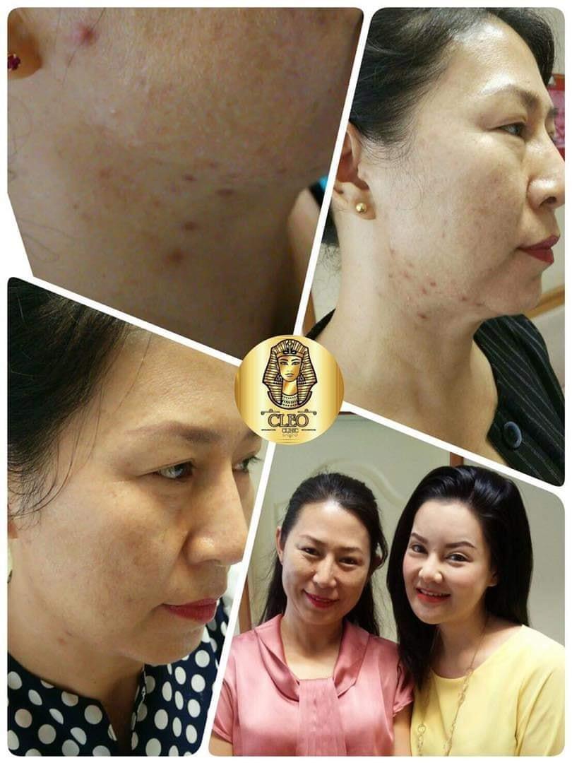 รีวิว ปี 62