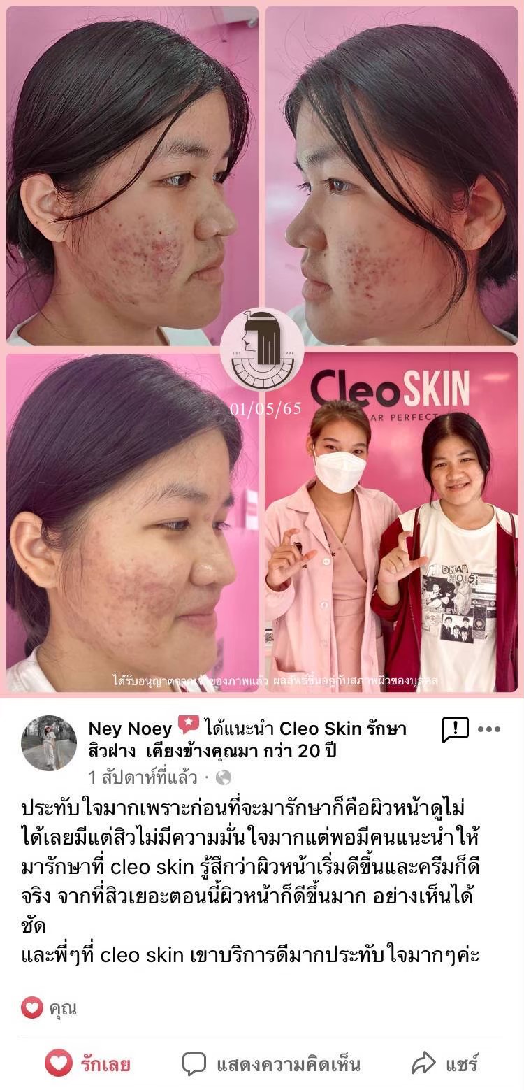 รีวิว ปี 62