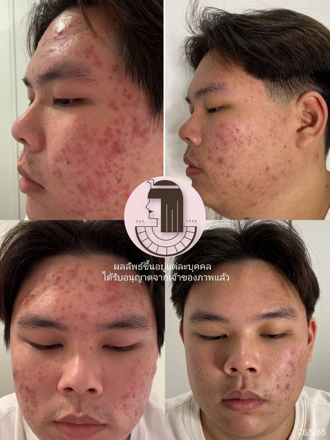 รีวิว ปี 62