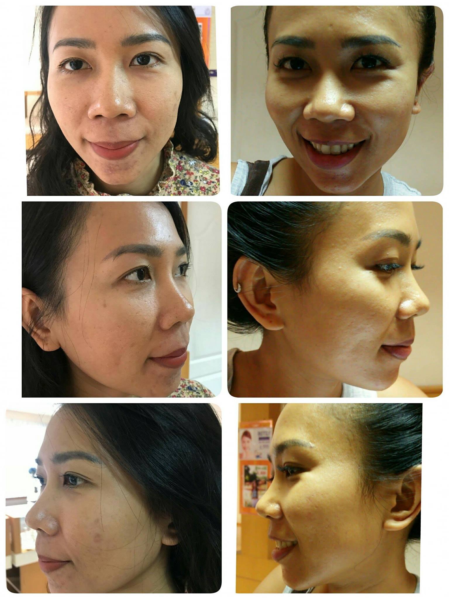 รีวิว ปี 62