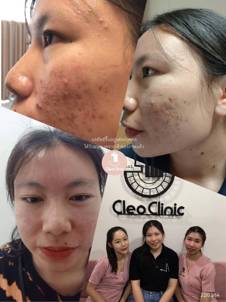 รีวิว ปี 62