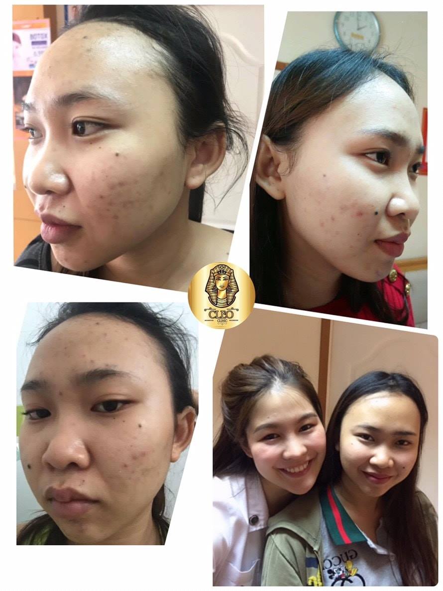 รีวิว ปี 62