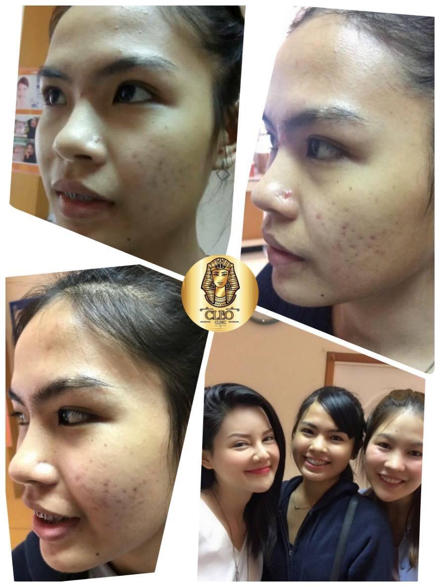 รีวิว ปี 62