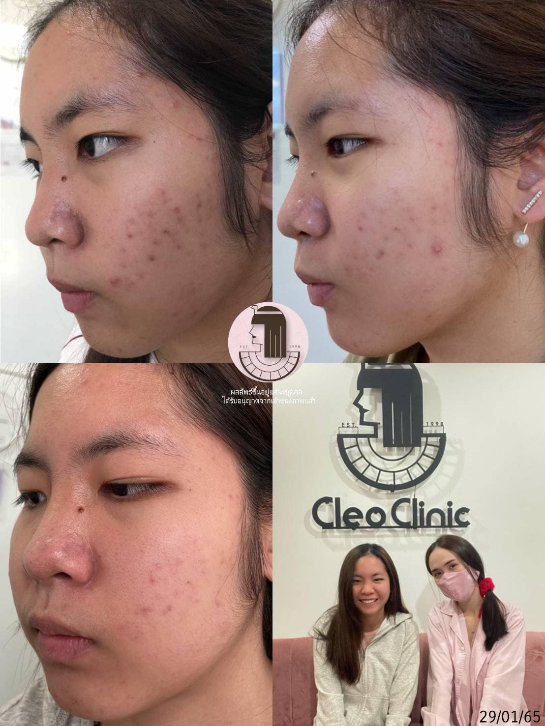 รีวิว ปี 62