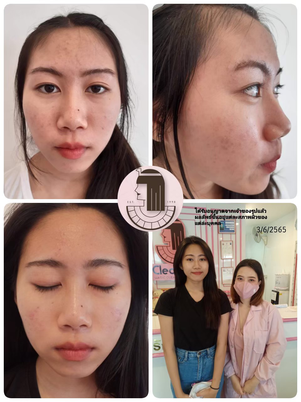 รีวิว ปี 62