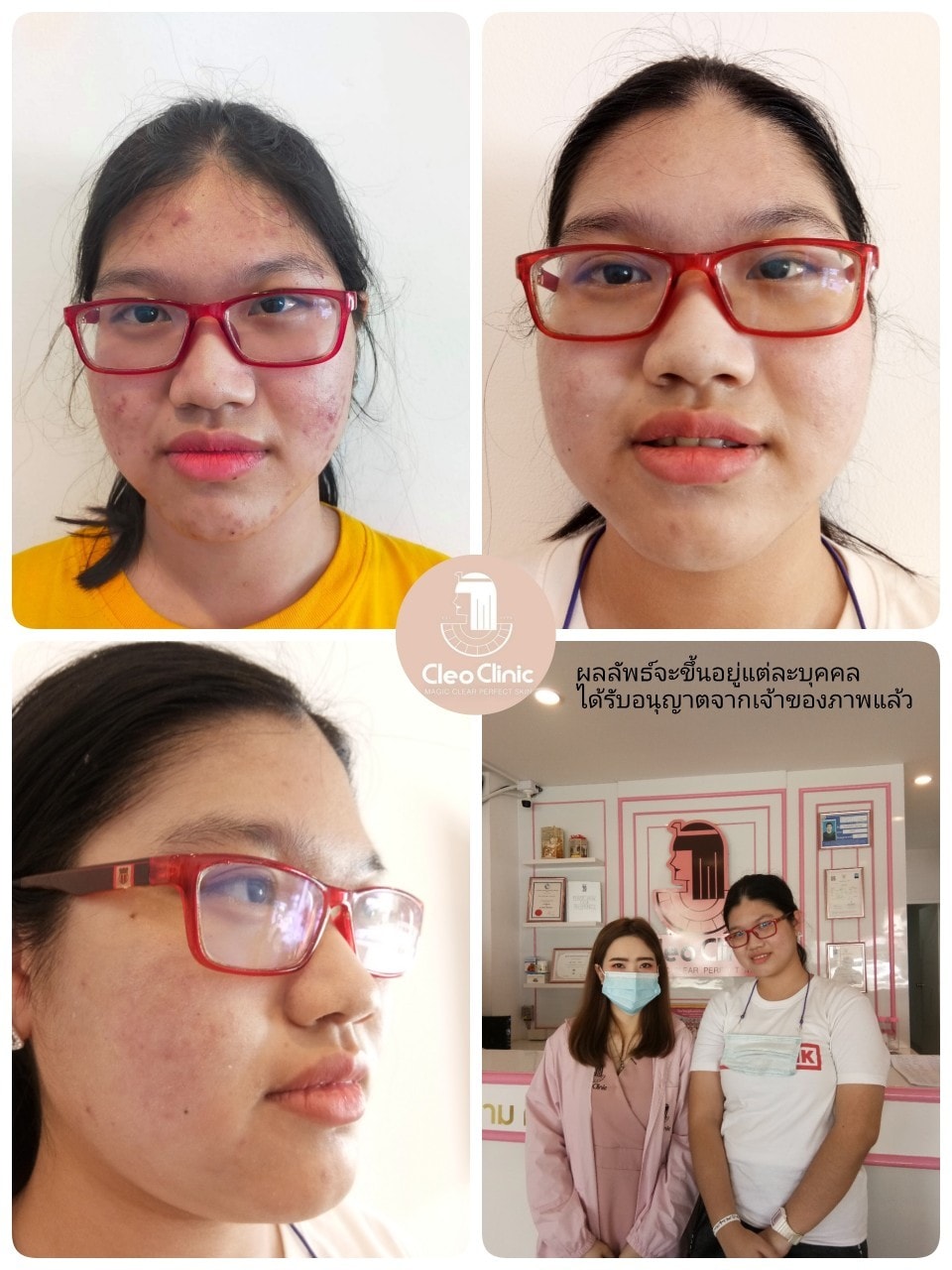 รีวิว ปี 62