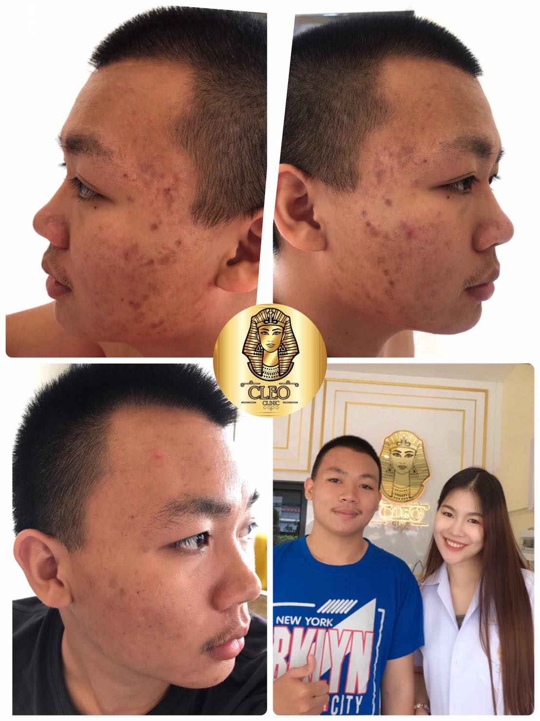 รีวิว ปี 62