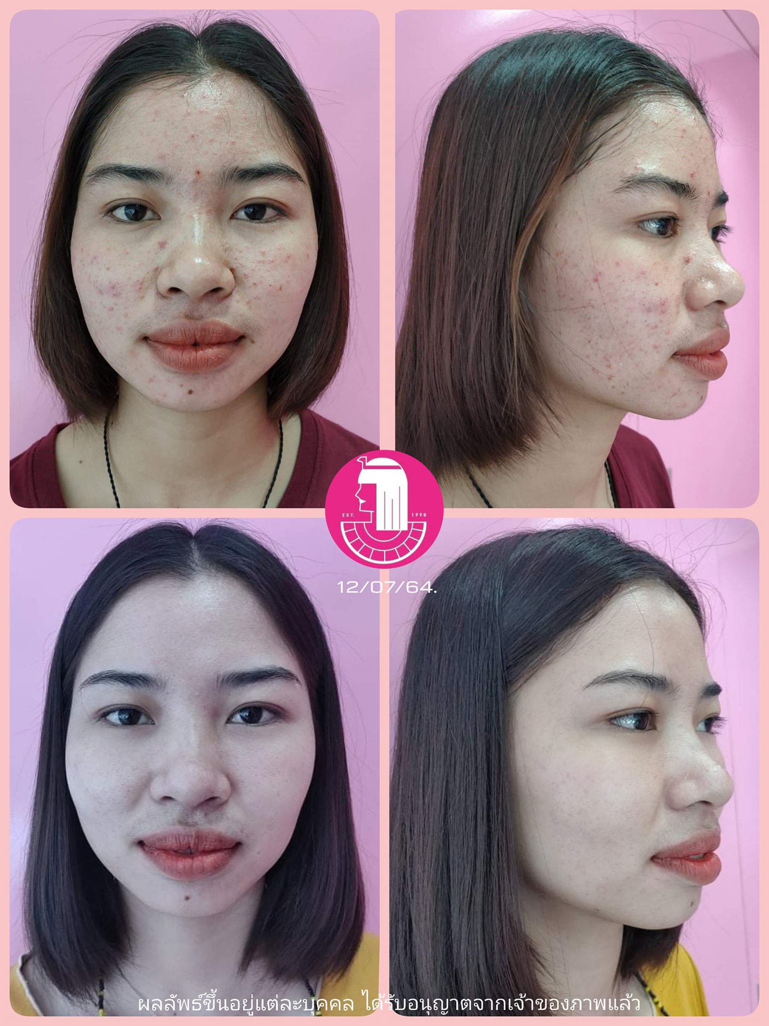 รีวิว ปี 62