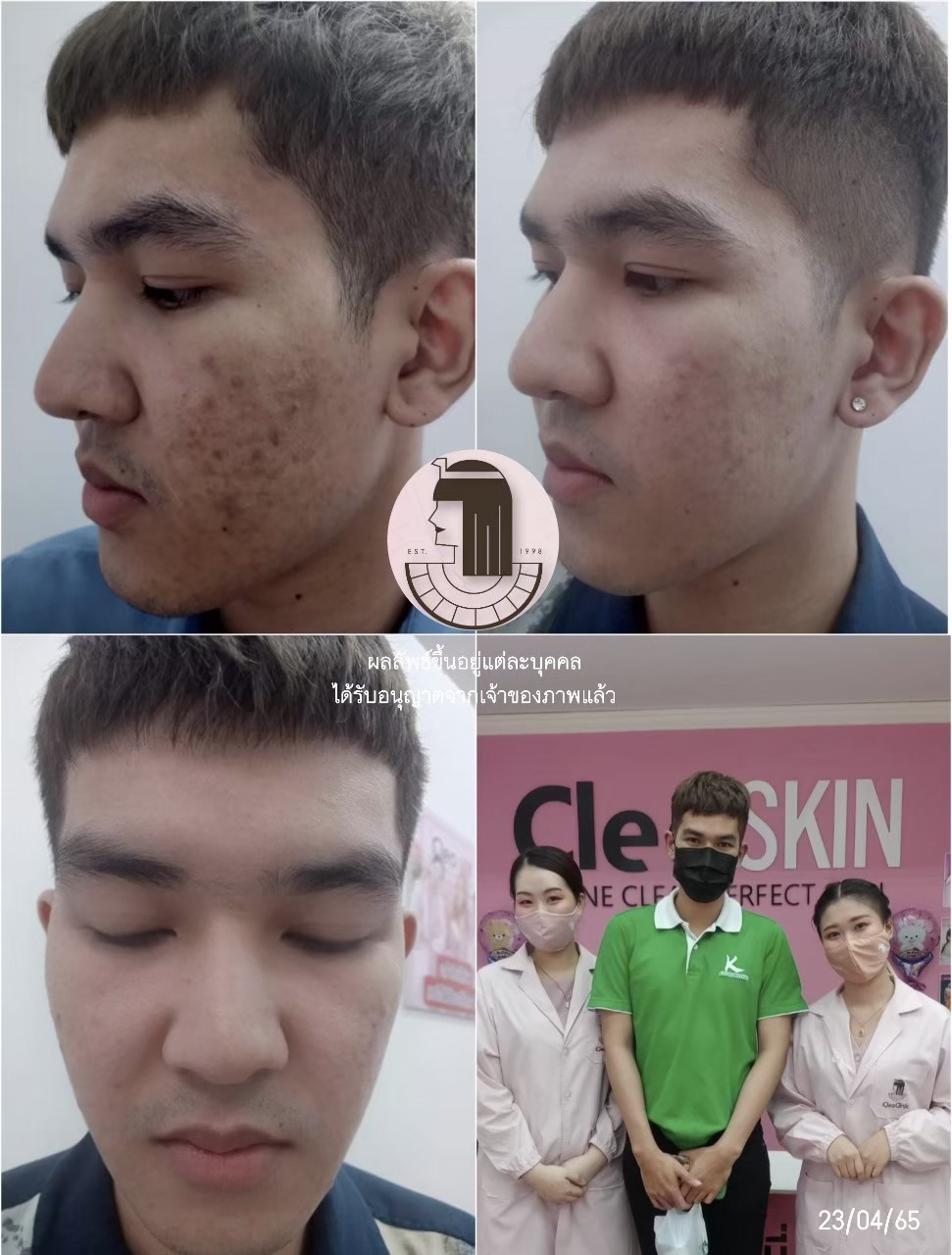 รีวิว ปี 62