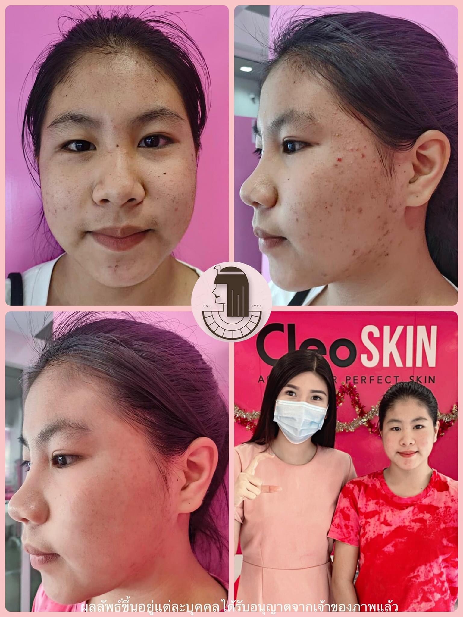 รีวิว ปี 62