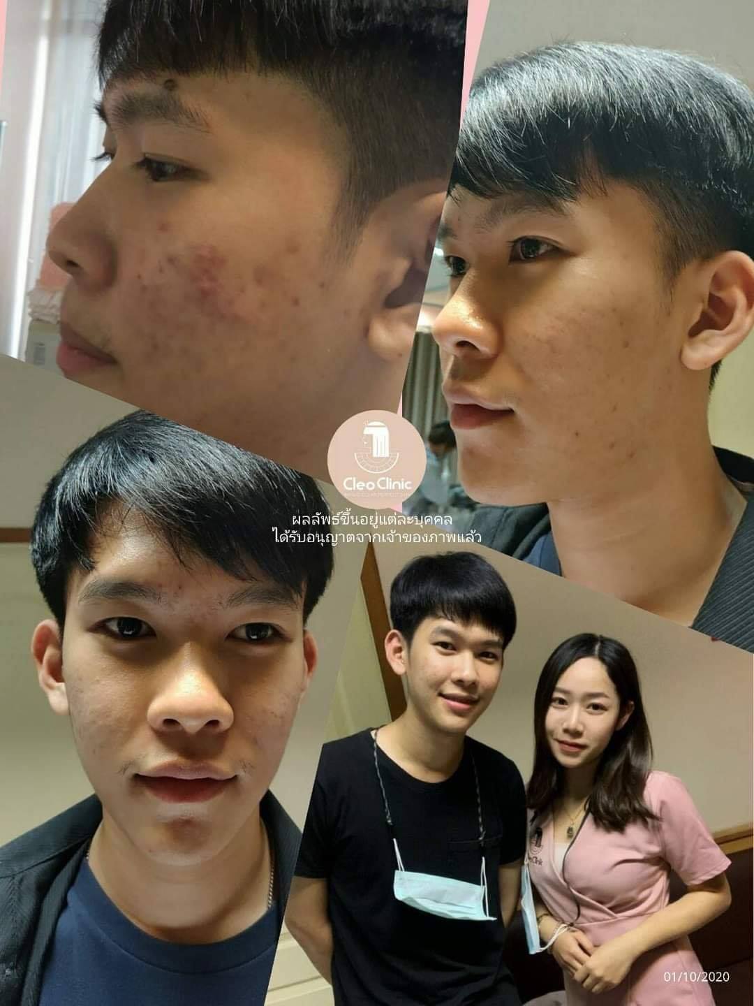 รีวิว ปี 62