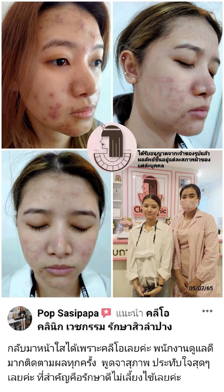 รีวิว ปี 62