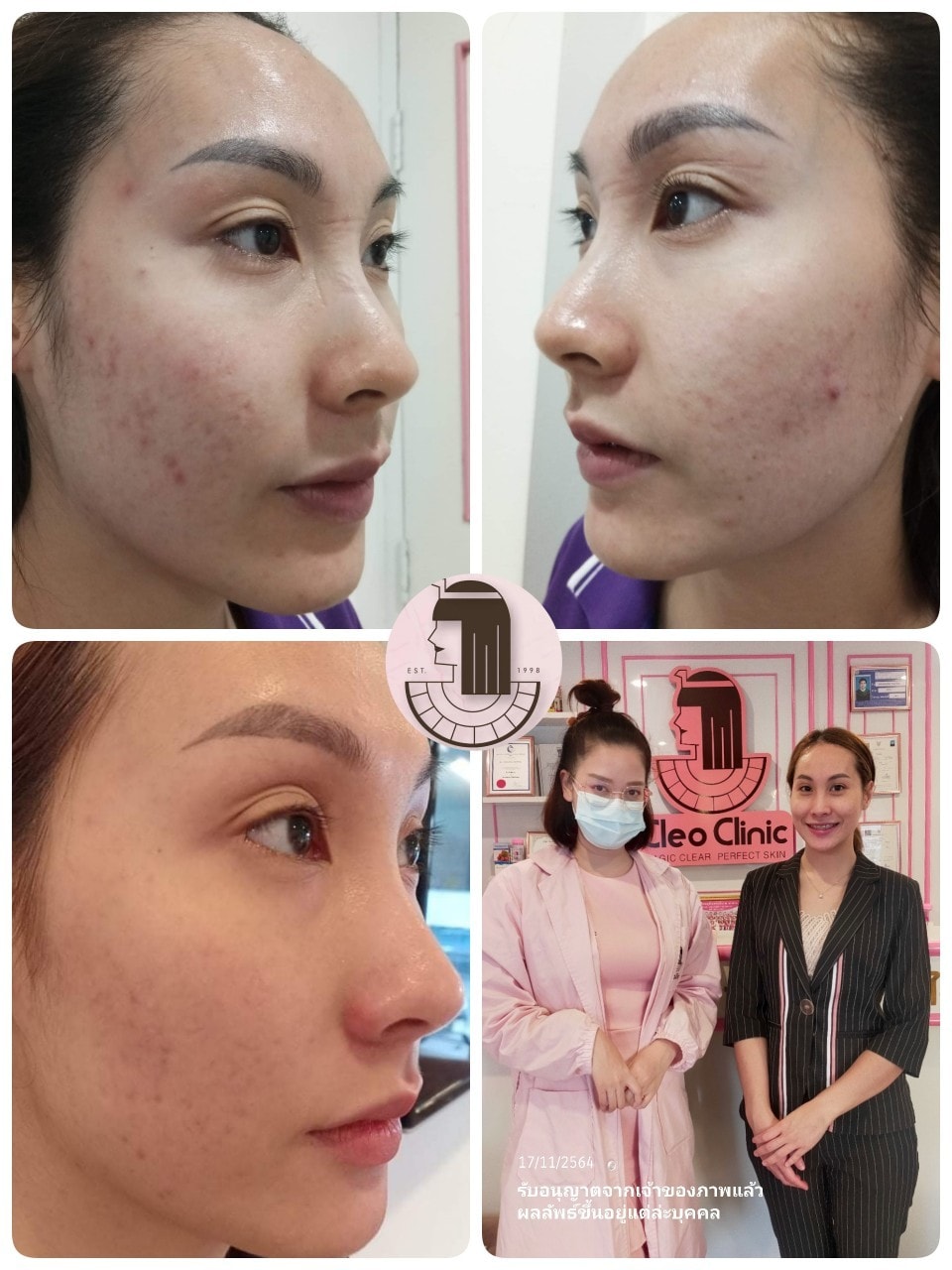 รีวิว ปี 62