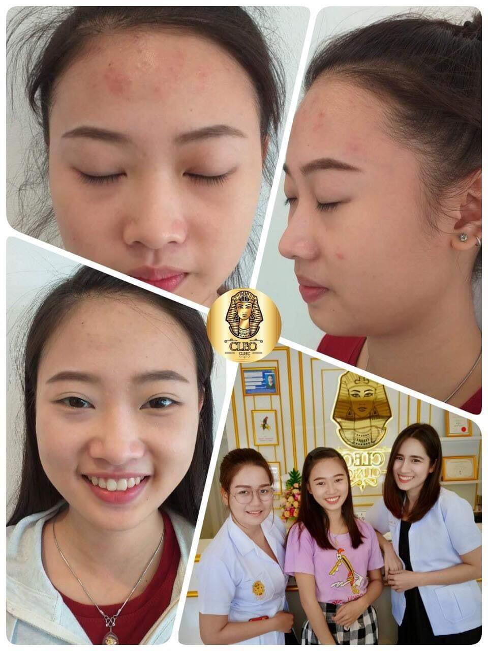 รีวิว ปี 62