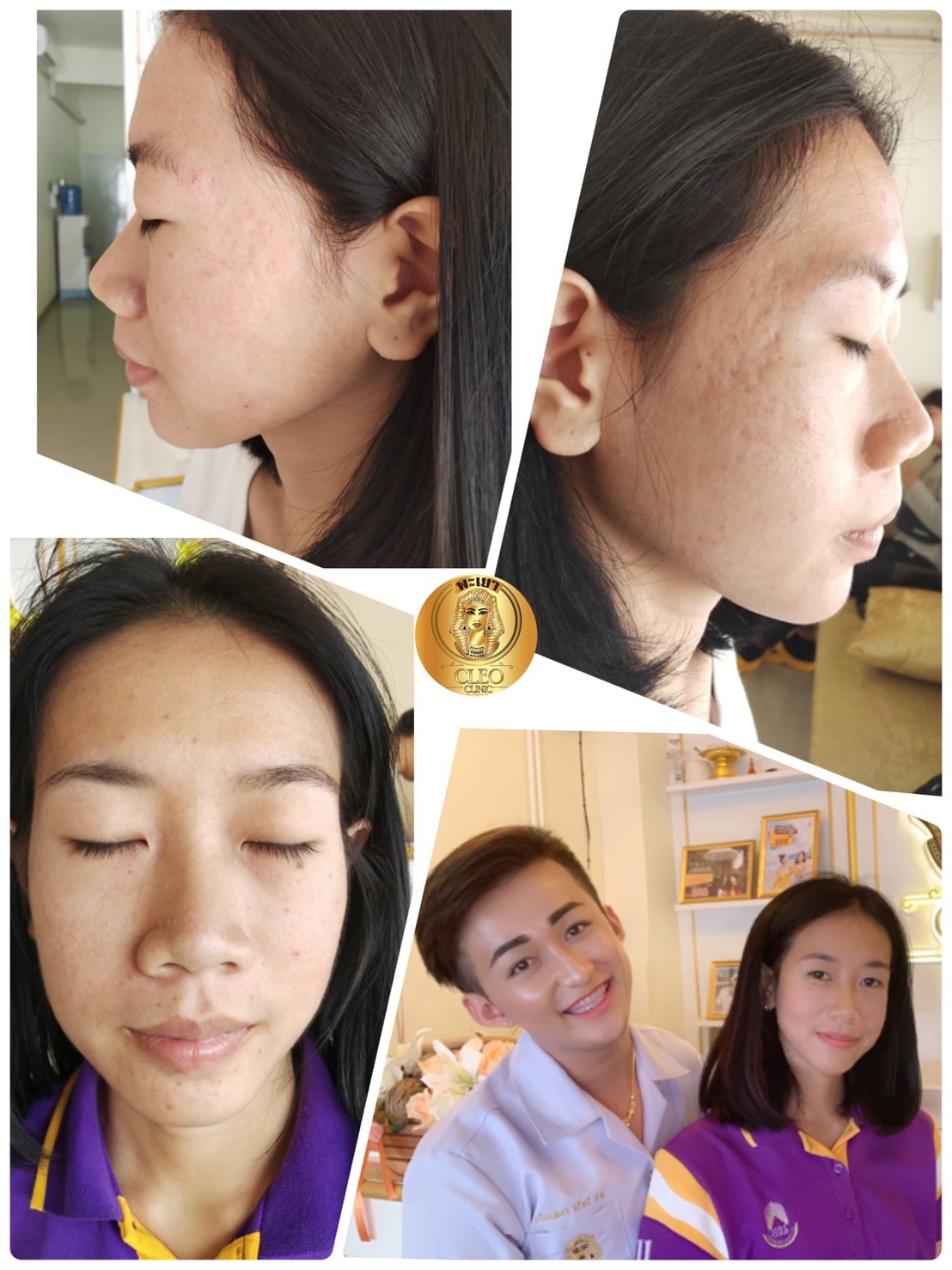 รีวิว ปี 62