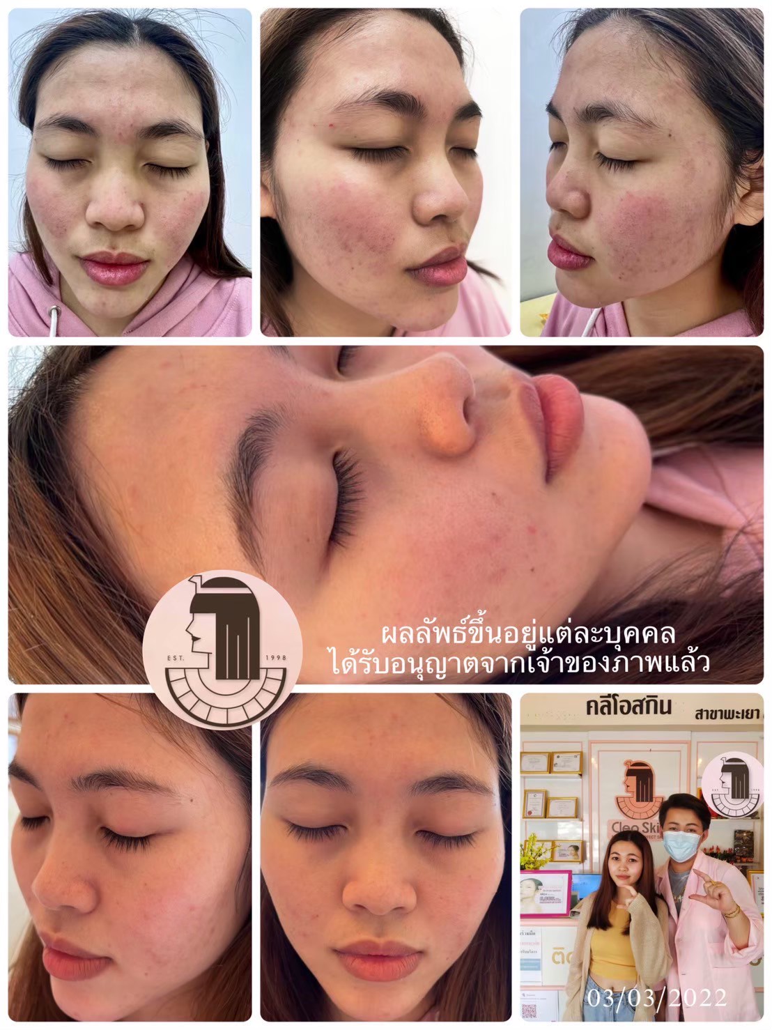 รีวิว ปี 62