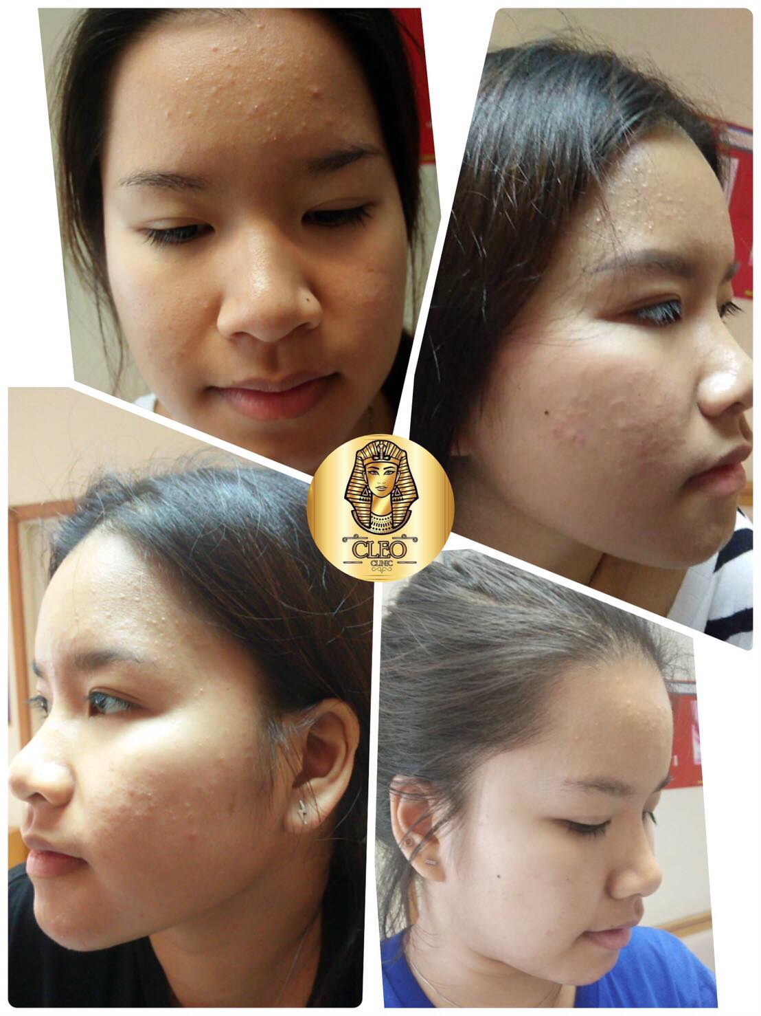 รีวิว ปี 62