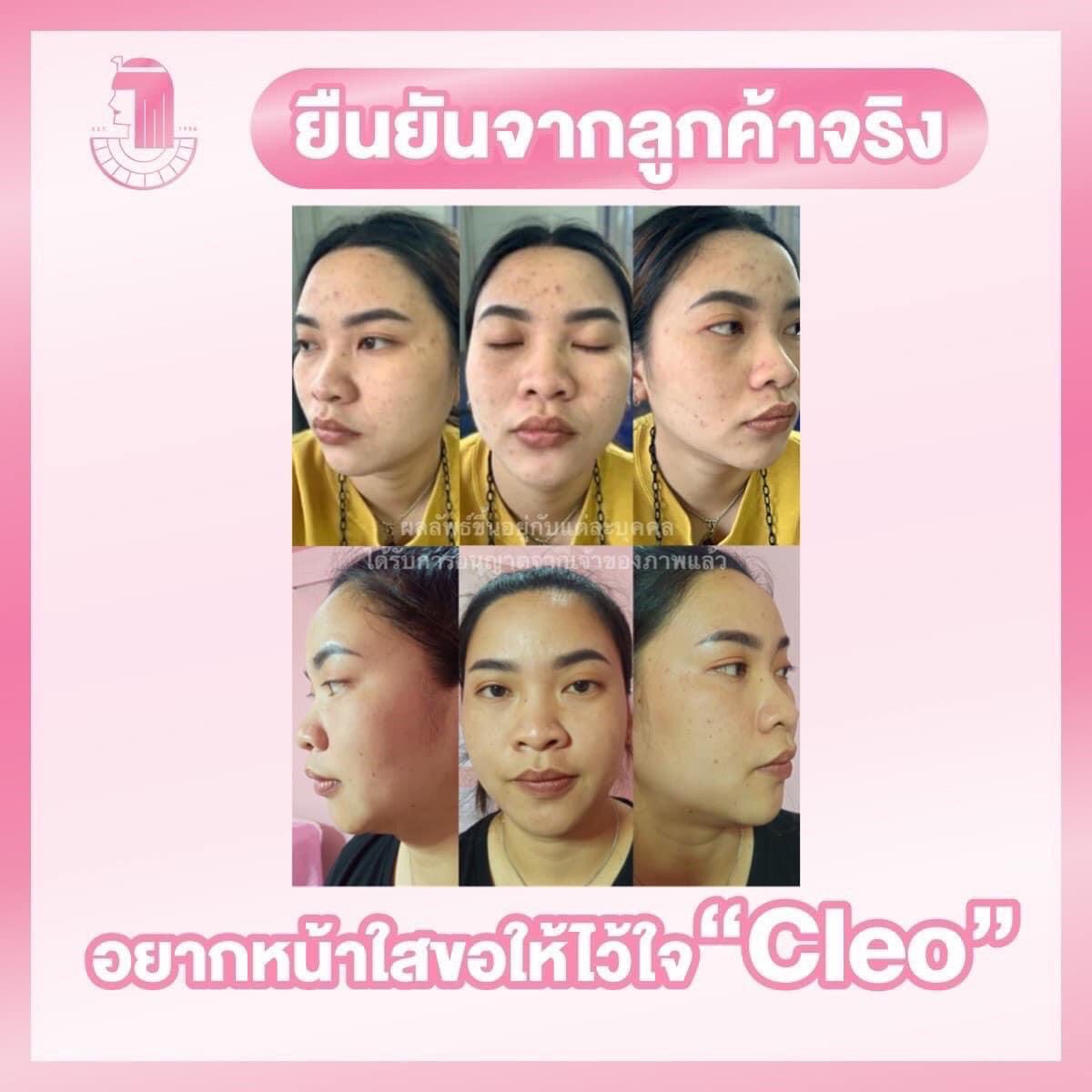 รีวิว ปี 62