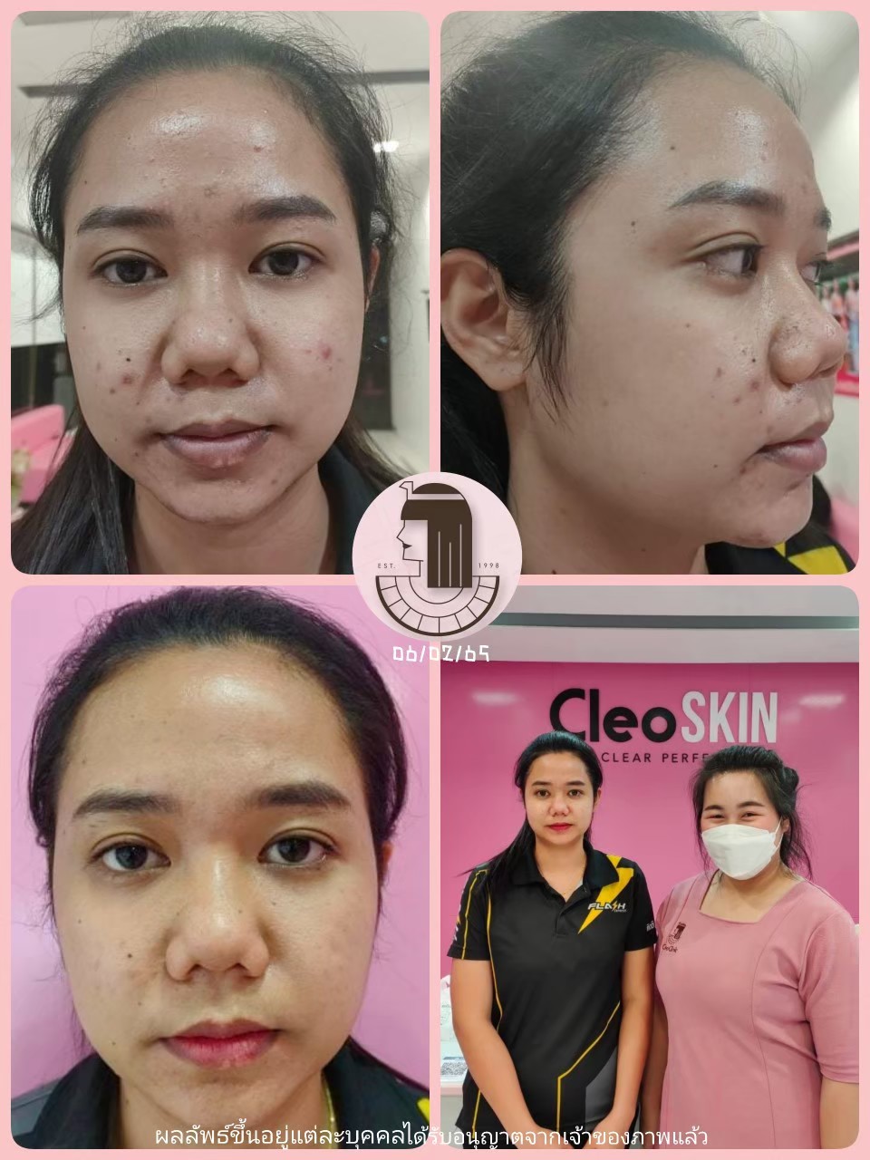 รีวิว ปี 62