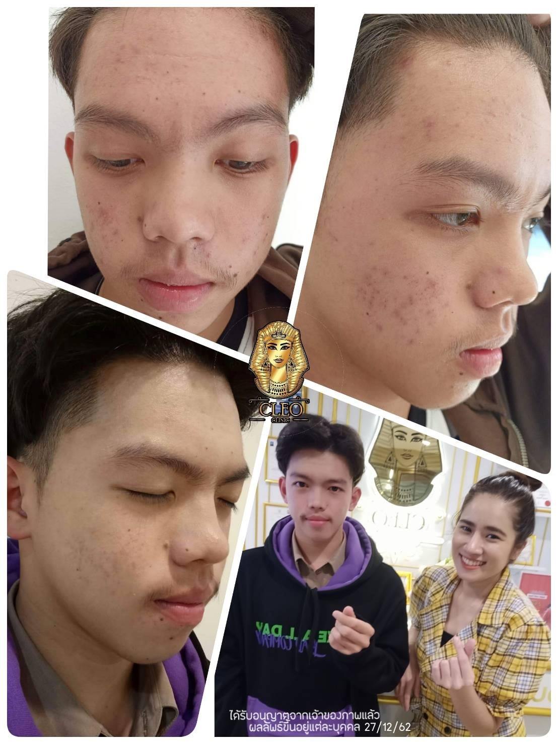 รีวิว ปี 62