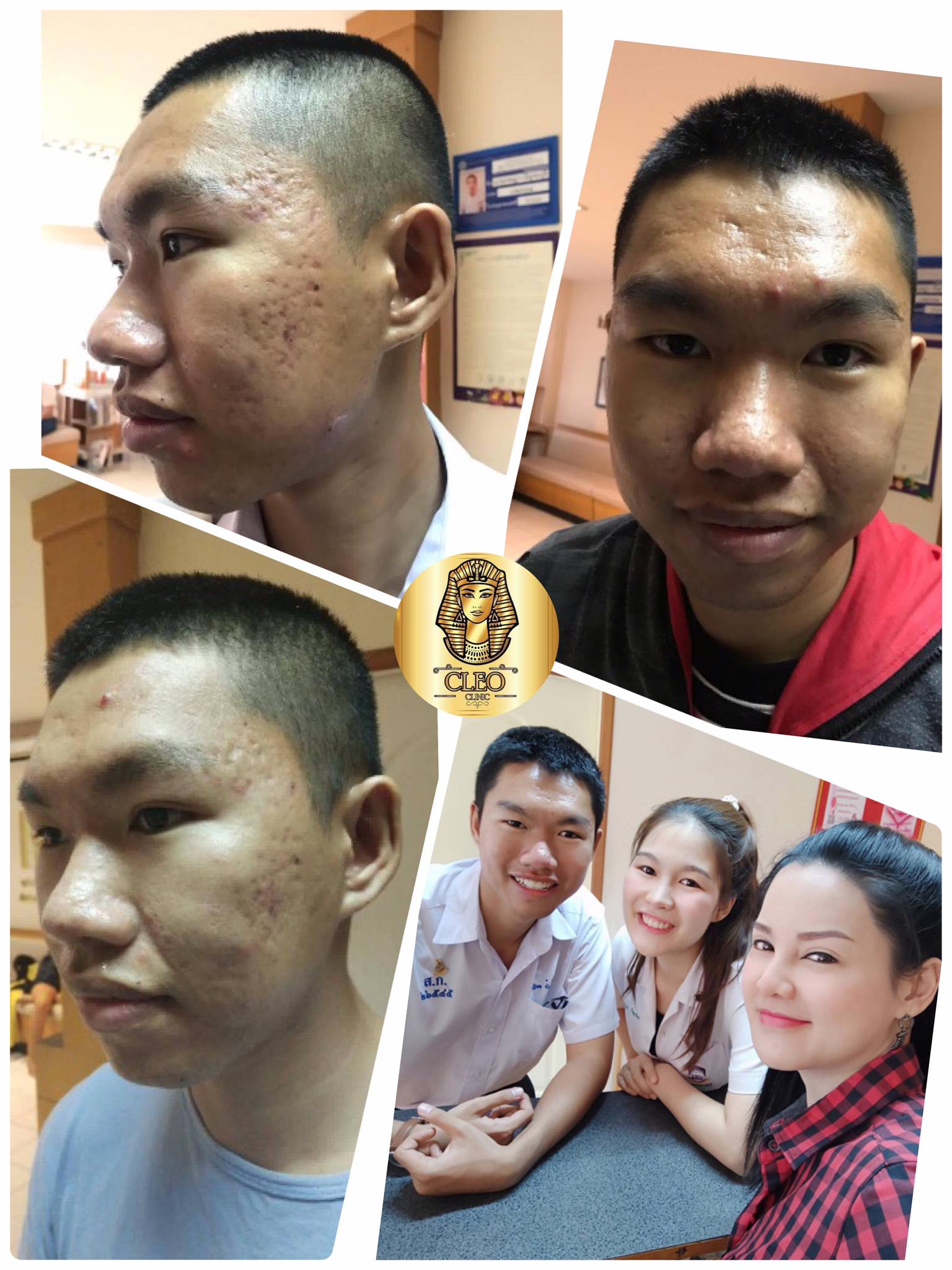 รีวิว ปี 62