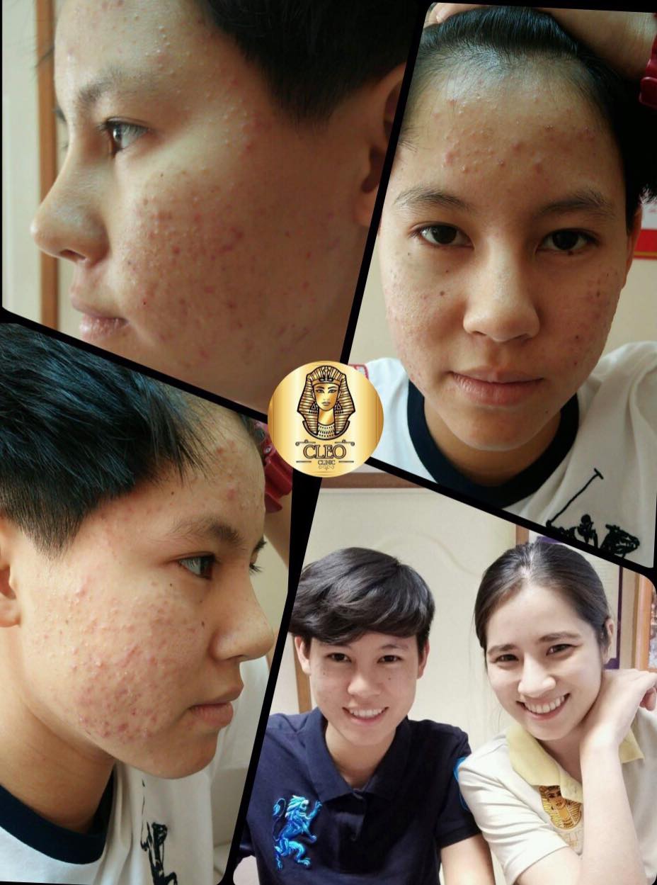 รีวิว ปี 62