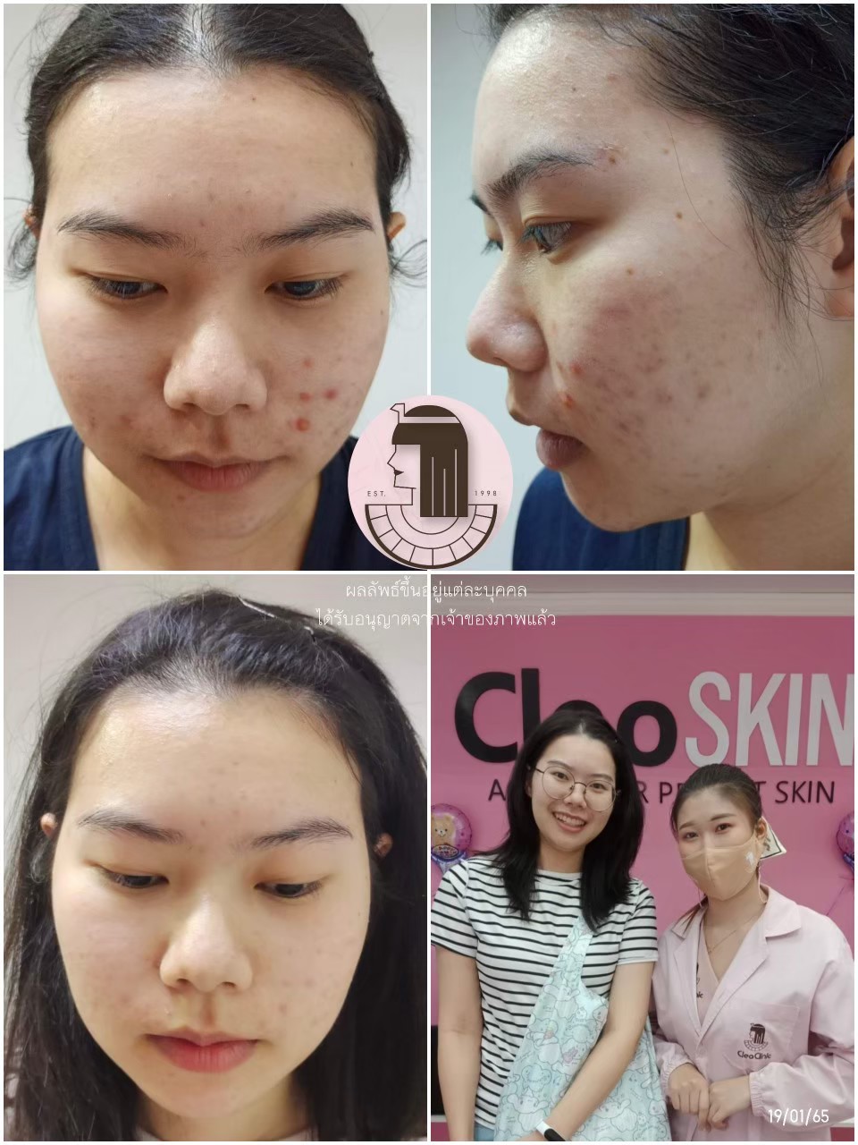 รีวิว ปี 62