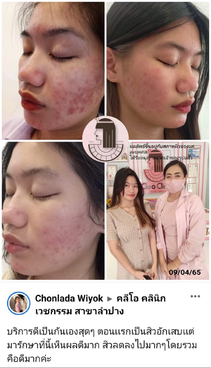 รีวิว ปี 62