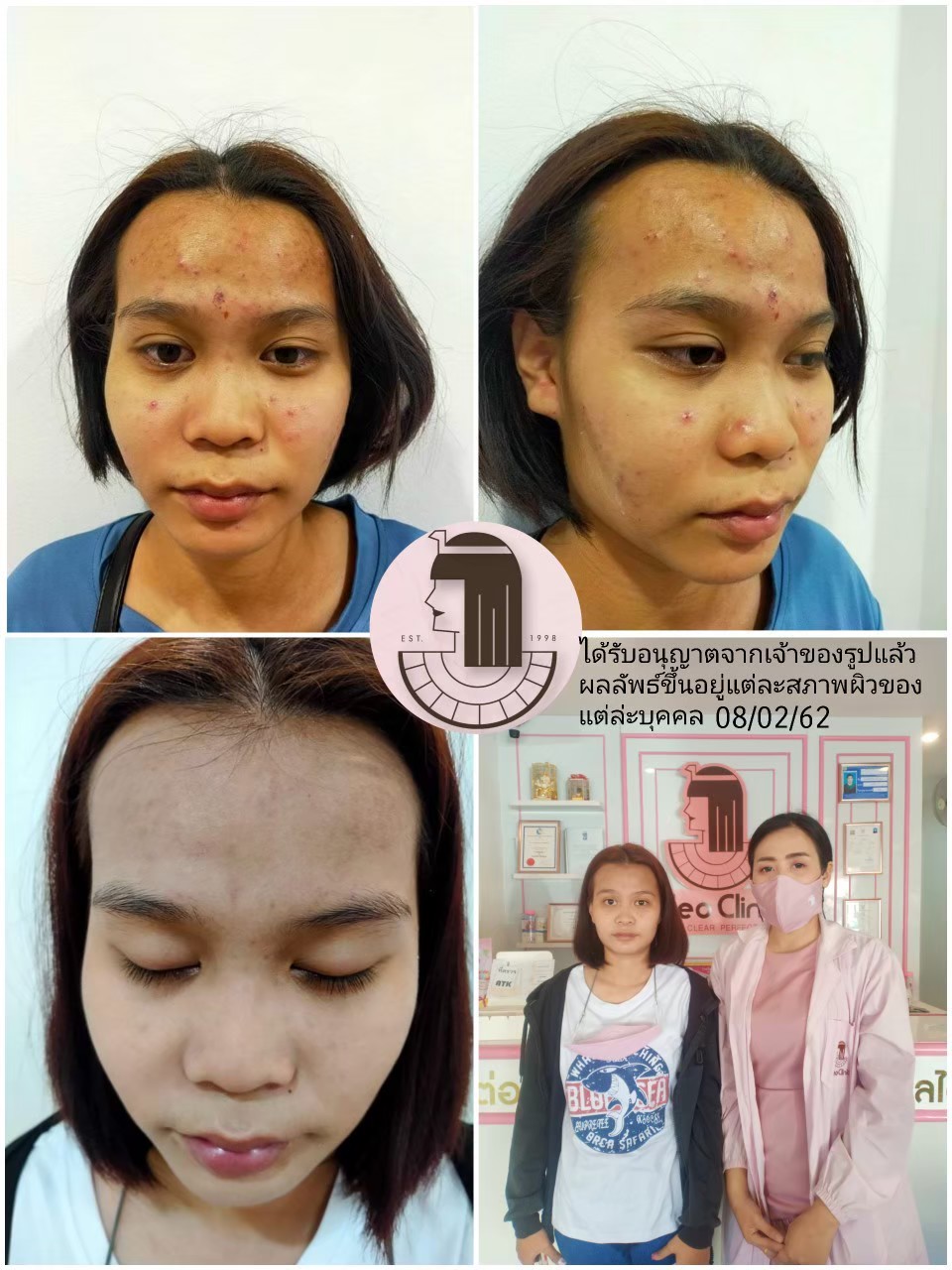 รีวิว ปี 62