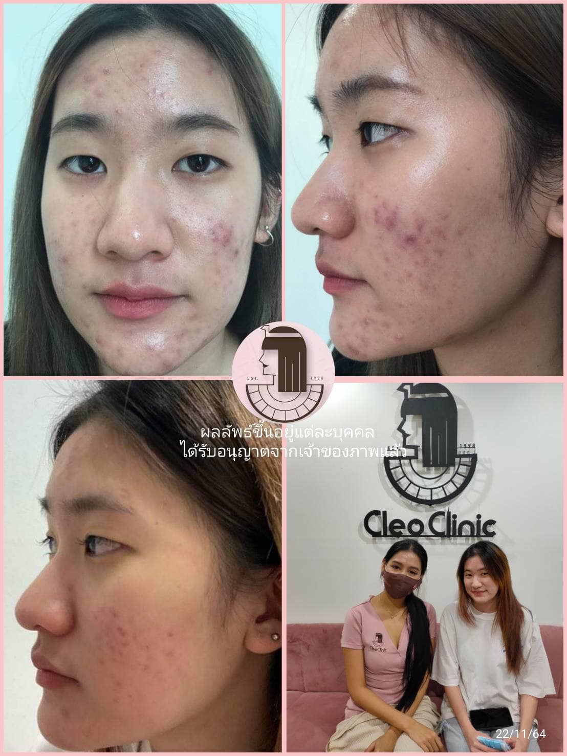 รีวิว ปี 62