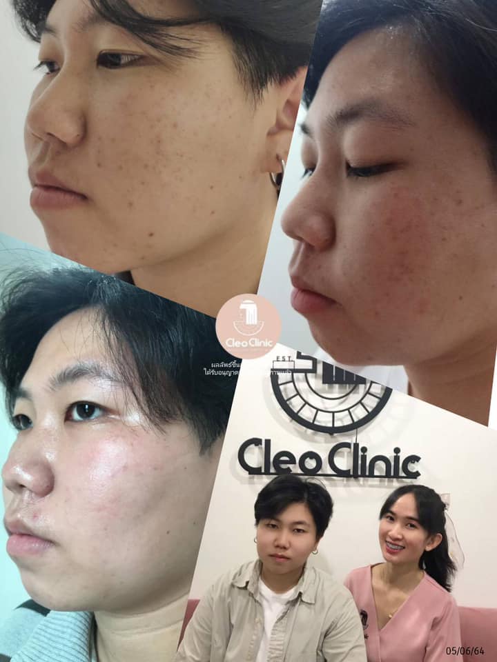 รีวิว ปี 62