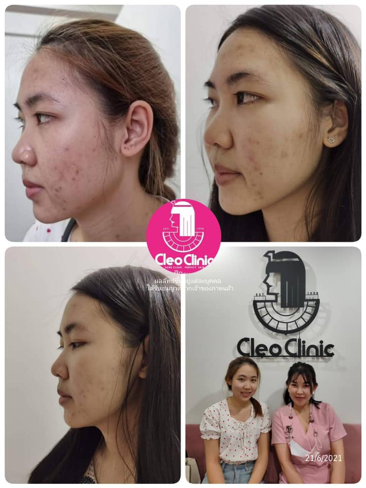 รีวิว ปี 62