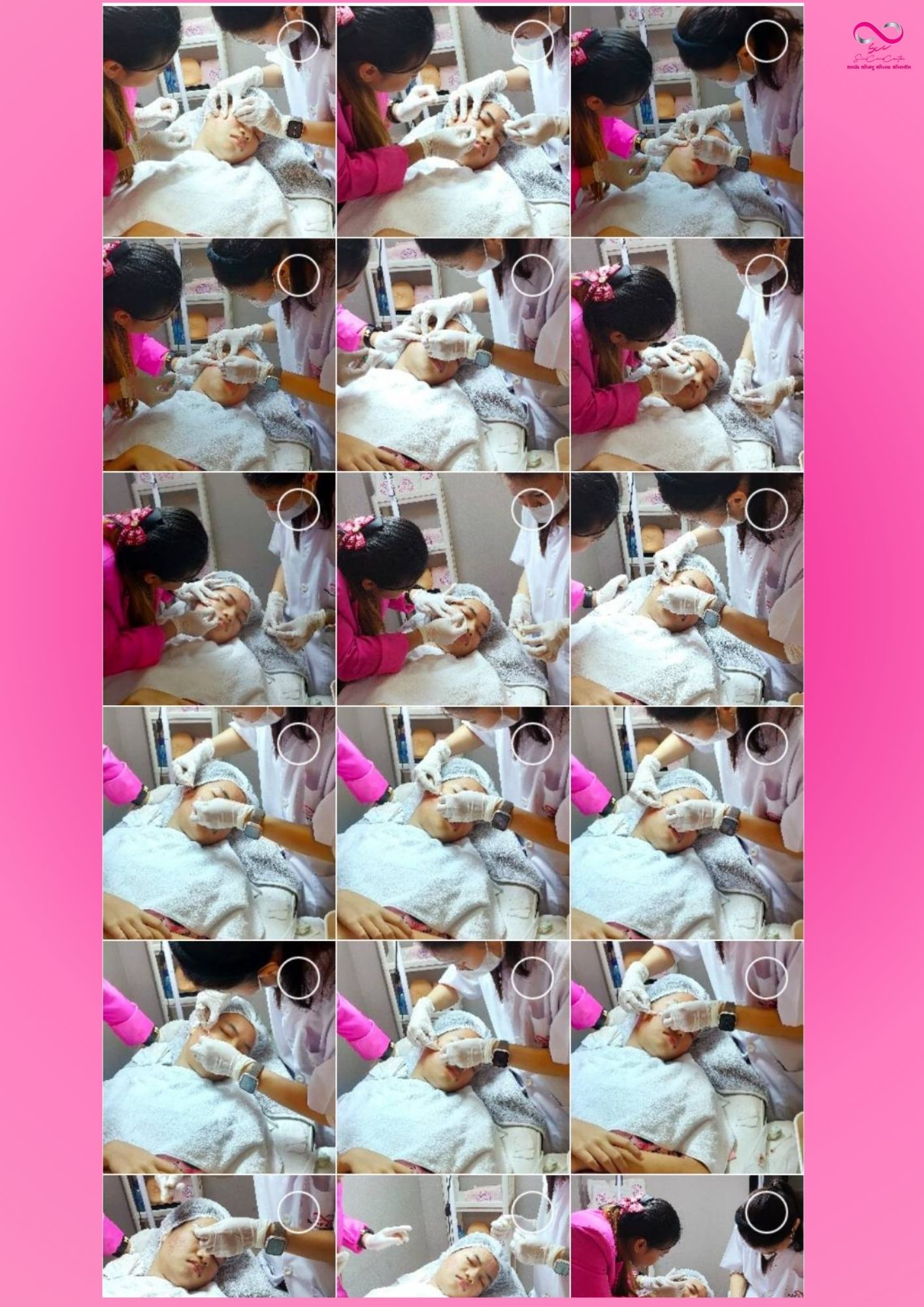 เรียนกดสิว หลักสูตรวิทยากรครูสอนกดสิว