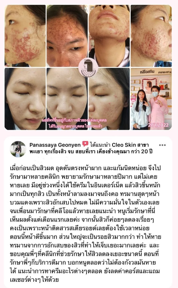 รีวิว ปี 62