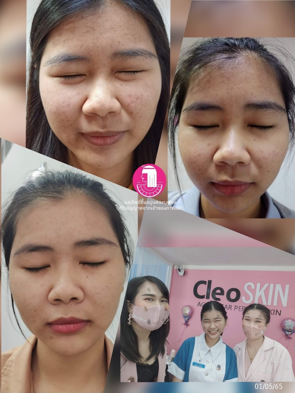 รีวิว ปี 62