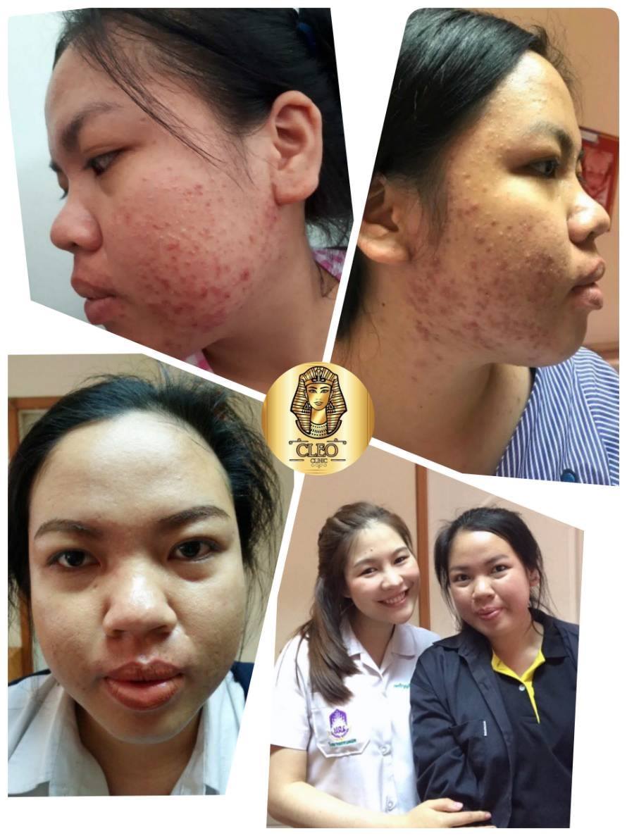 รีวิว ปี 62