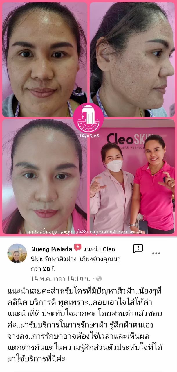 รีวิว ปี 62