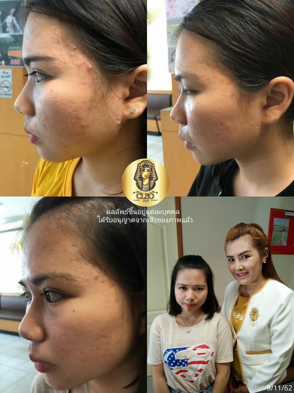 รีวิว ปี 62