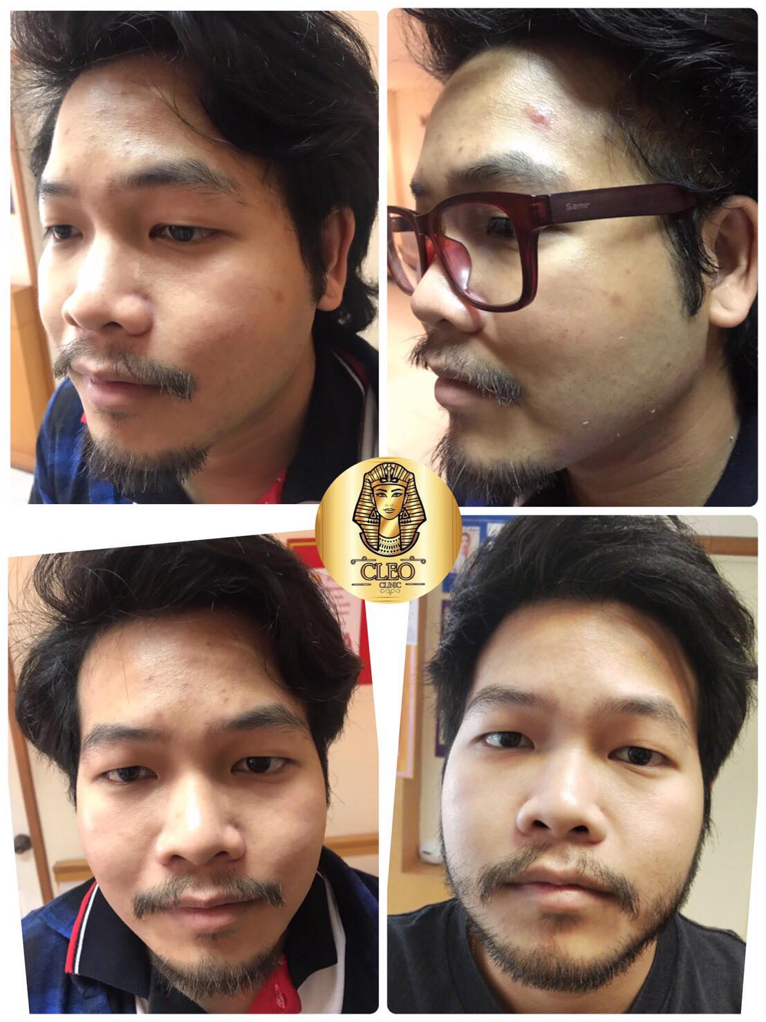 รีวิว ปี 62