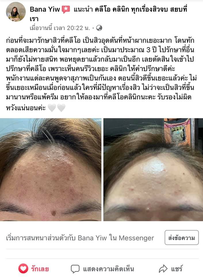 รีวิว ปี 62