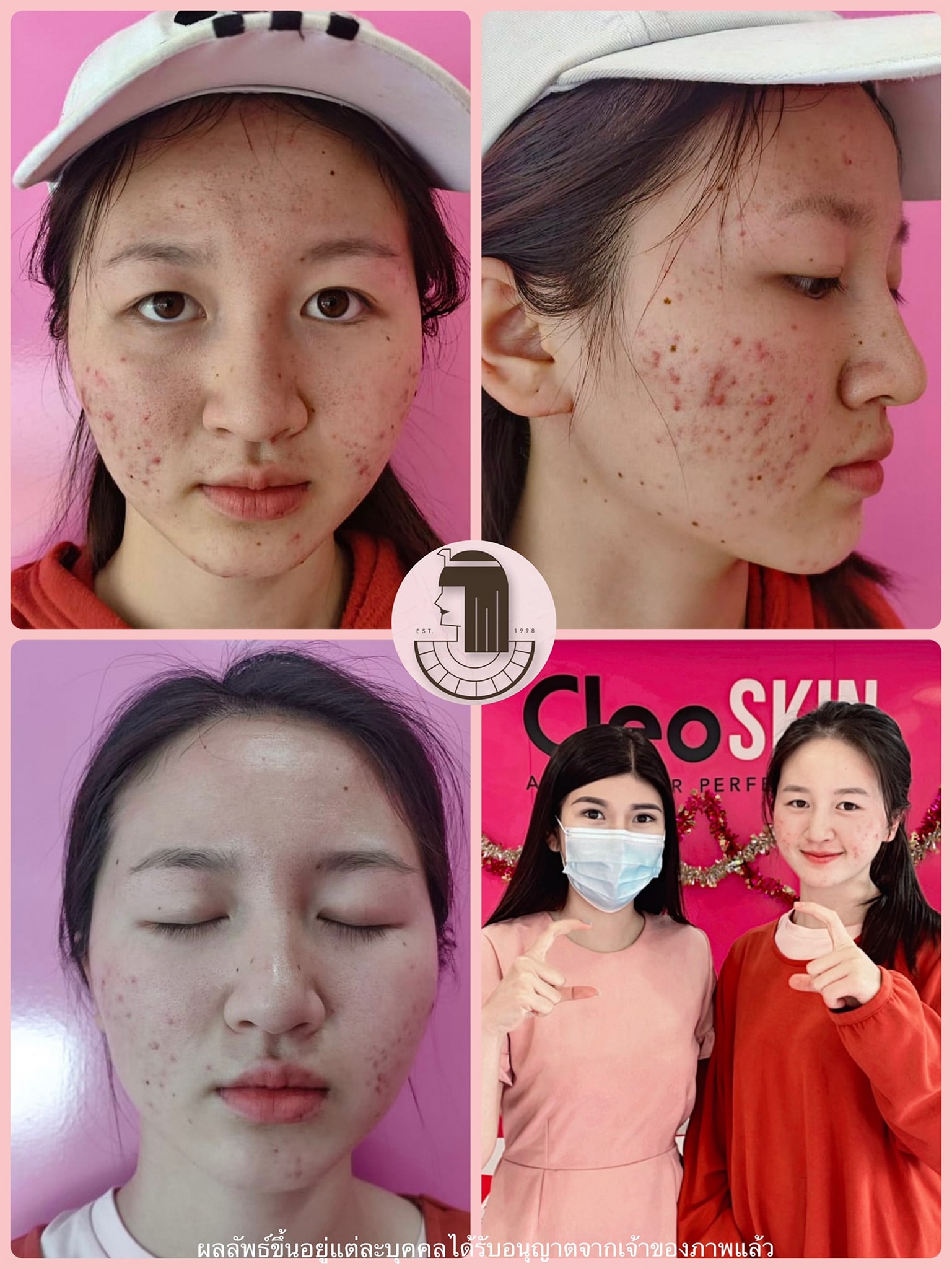 รีวิว ปี 62