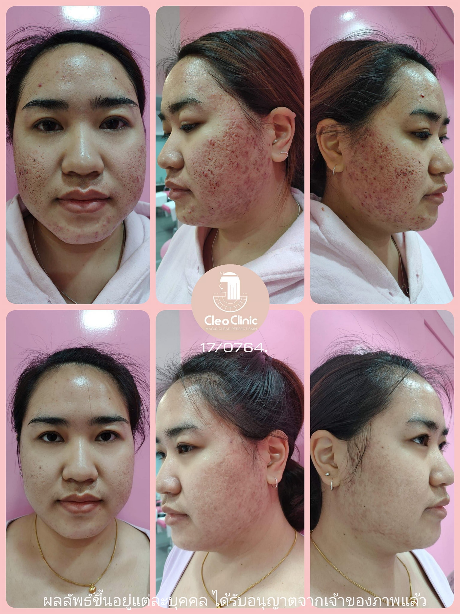 รีวิว ปี 62