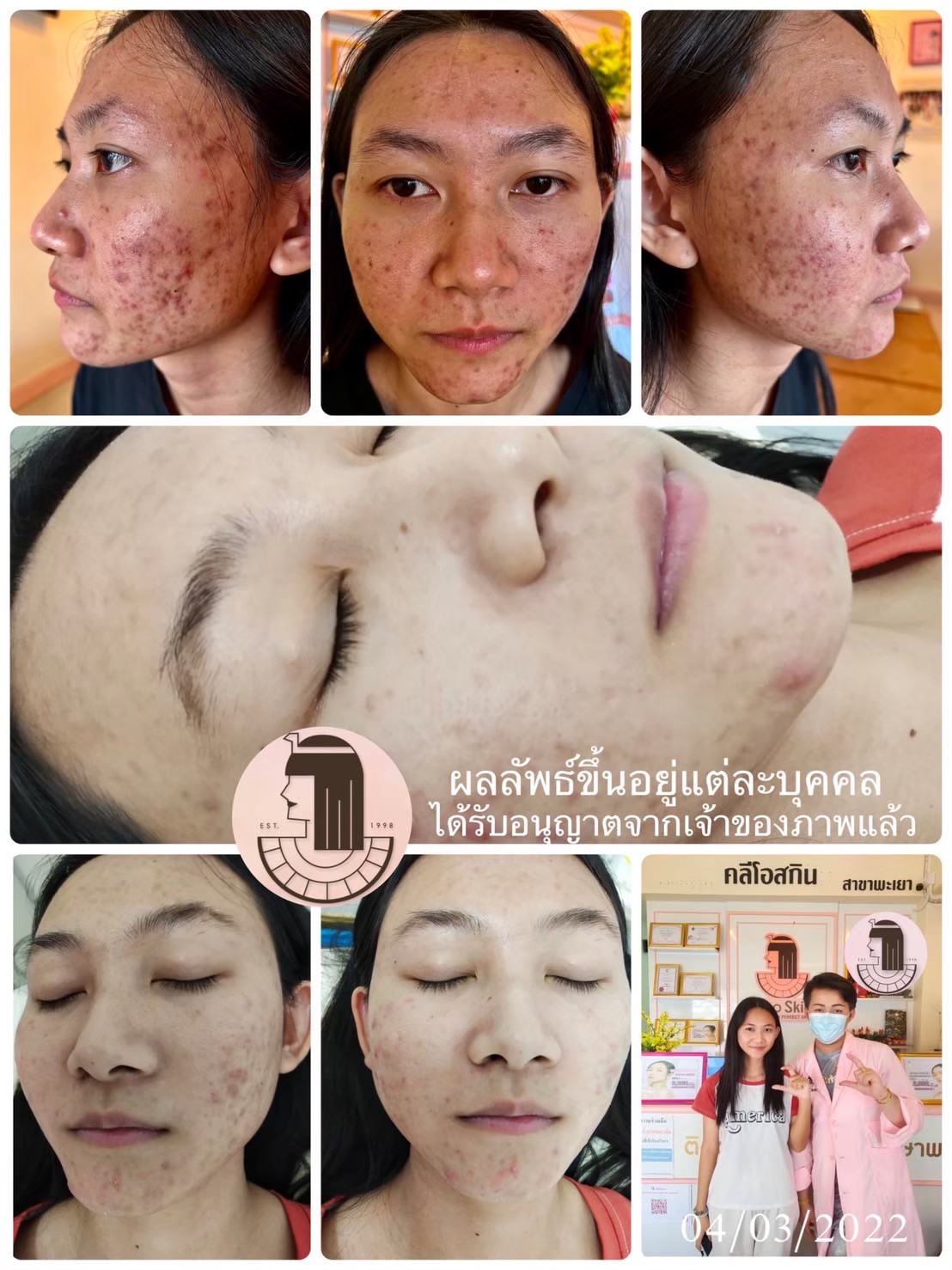 รีวิว ปี 62