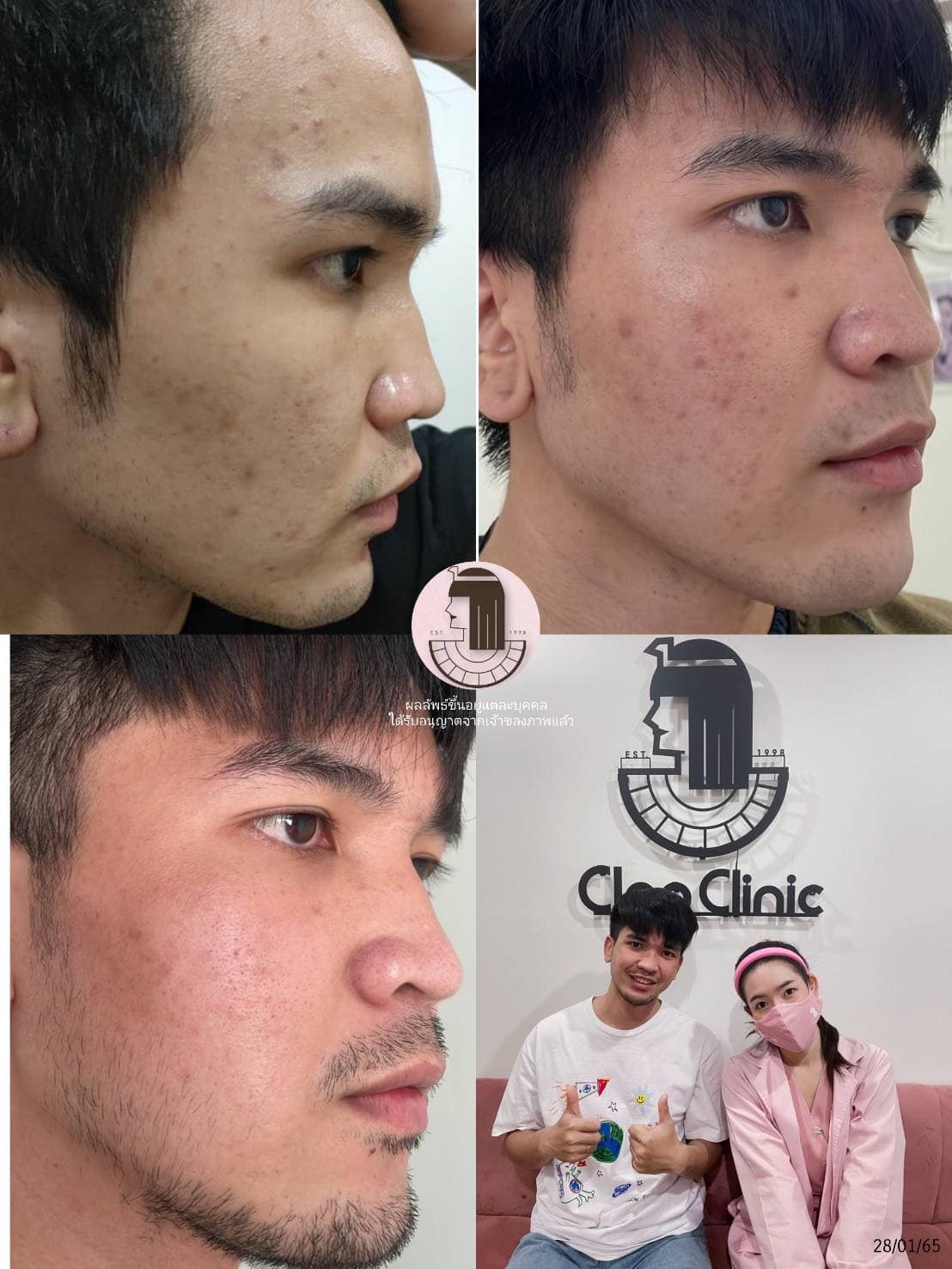 รีวิว ปี 62