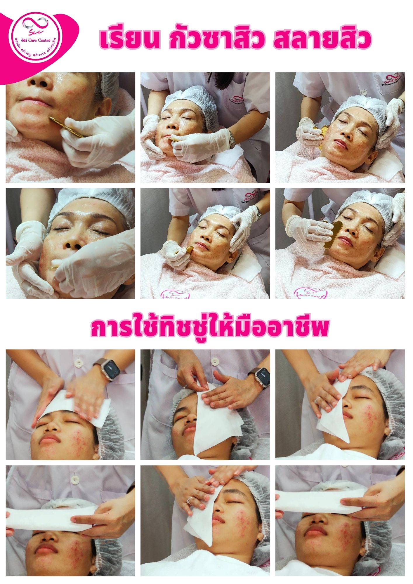 เรียนกดสิว หลักสูตรวิทยากรครูสอนกดสิว