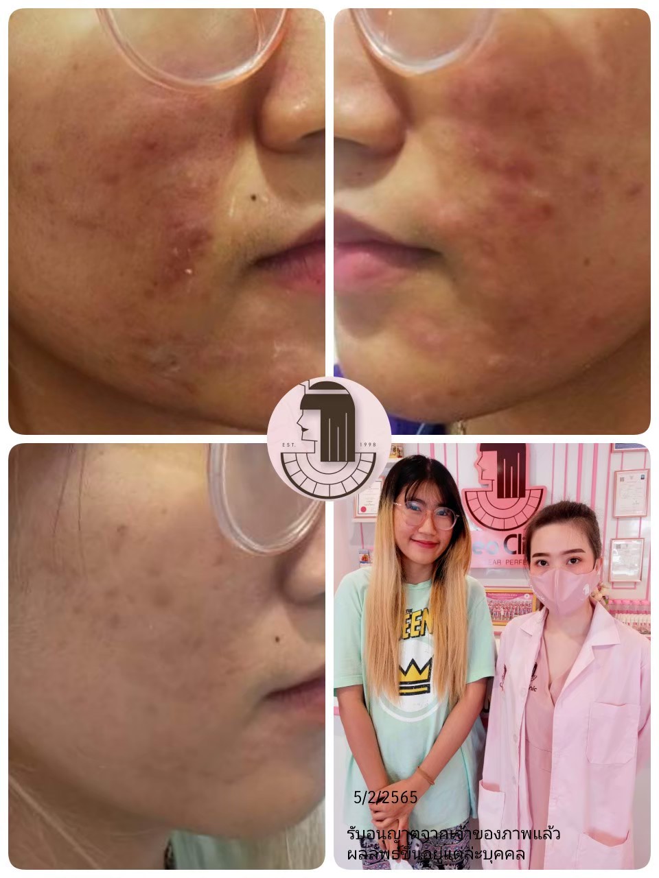 รีวิว ปี 62