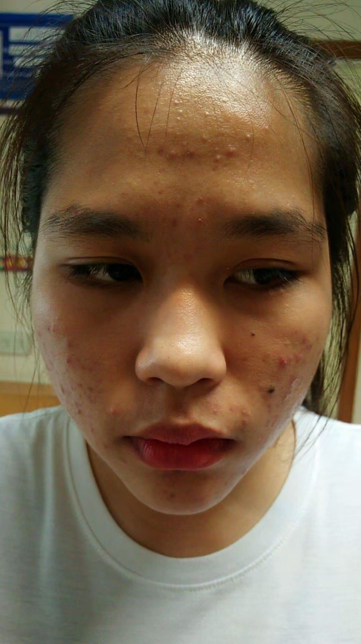 รีวิว ปี 62